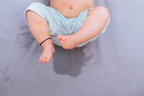 Bed-Wetting - Symptoms , Causes And Treatment - Charlies Magazines