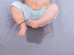 bed wetting (nocturnal enuresis)