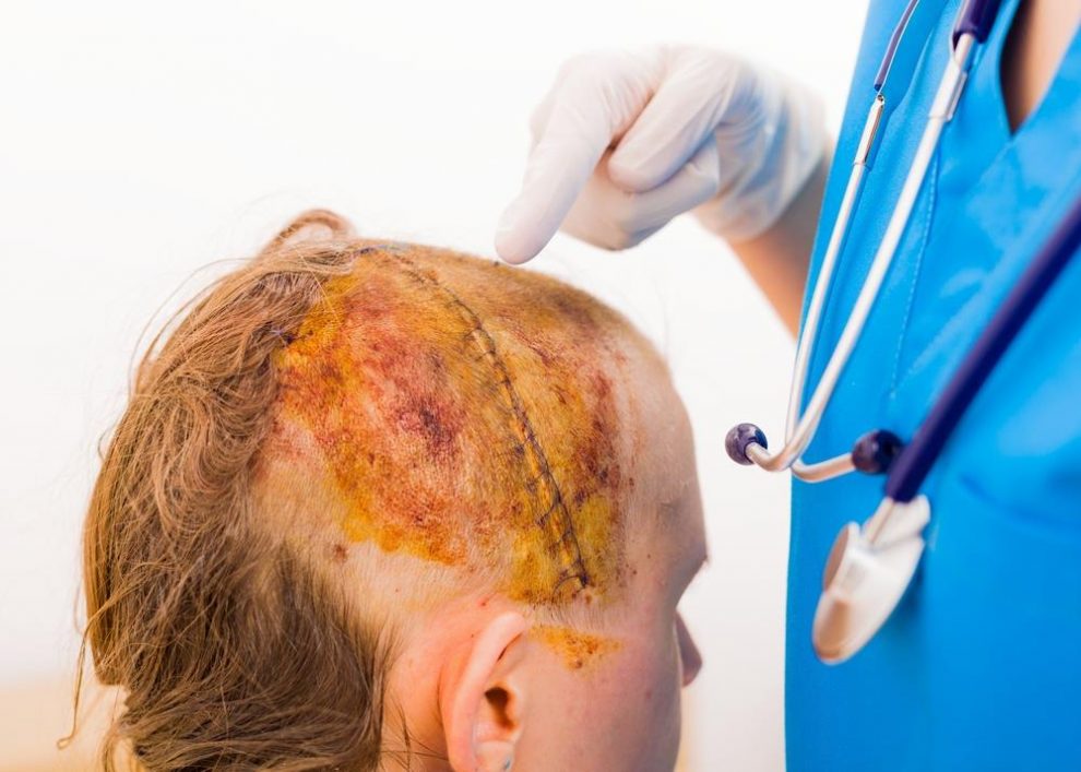 What Is A Neurosurgeon How Do I Become A Neurosurgeon Charlies