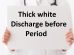 thick white discharge before period