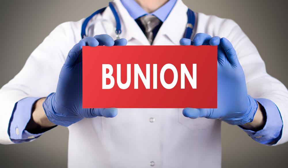 Bunions from medical point of view