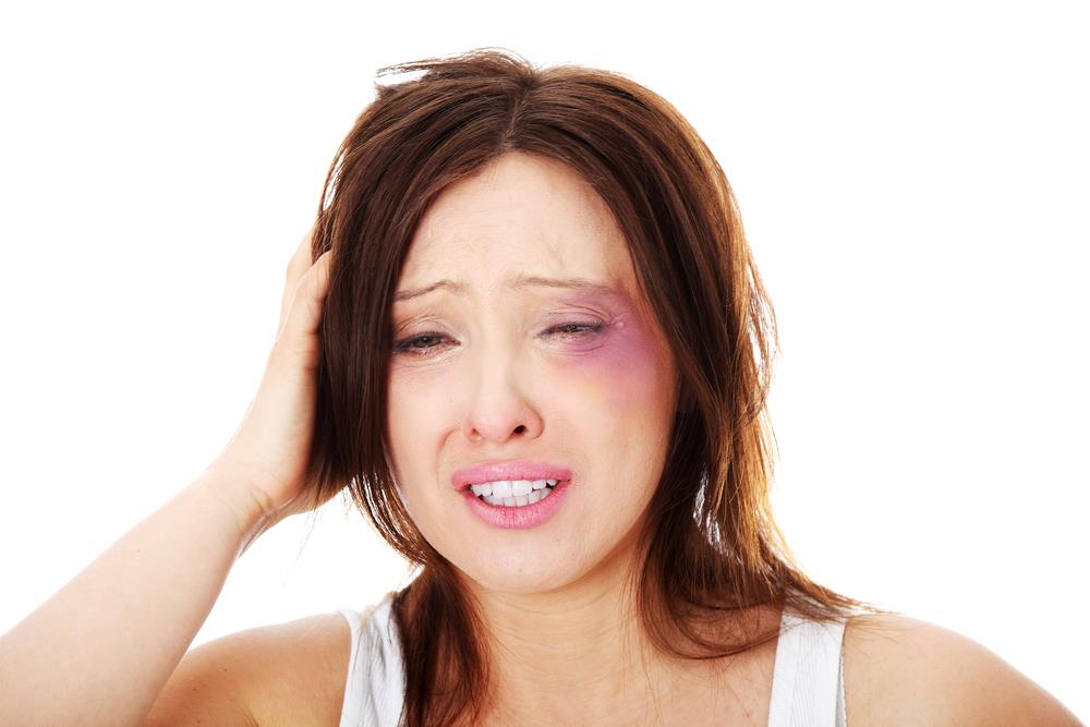 How to get rid of bruises fast and naturally ?