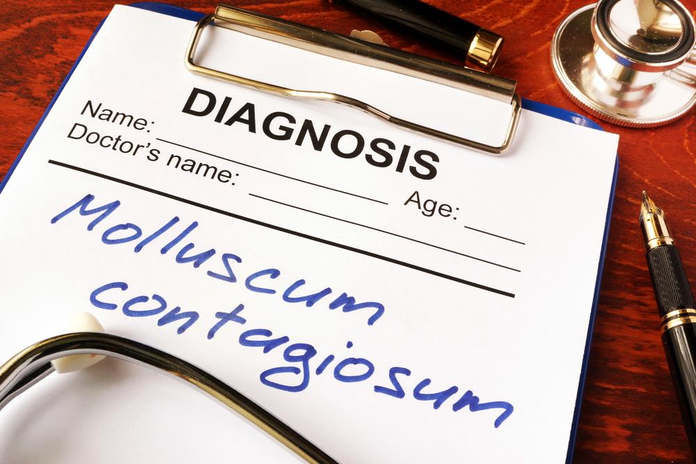 Molluscum Contagiosum