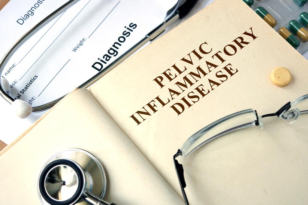 Pelvic Inflammatory Disease (PID)