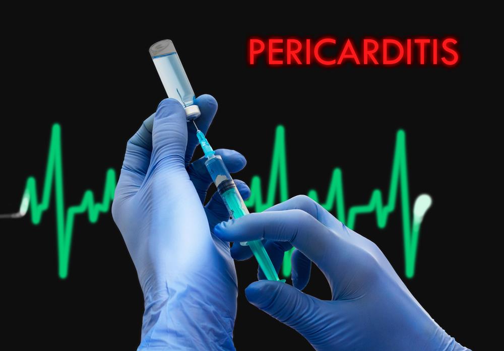 Pericarditis