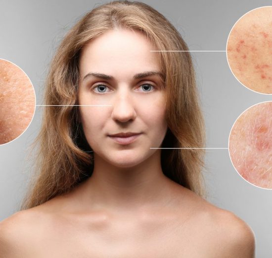 how to get rid of zits