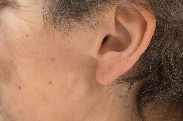 lumps-nodules-and-cysts-around-the-ears-the-clifford-clinic