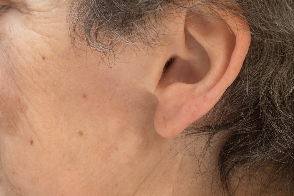 Treatment Options for Lumps Behind Ears