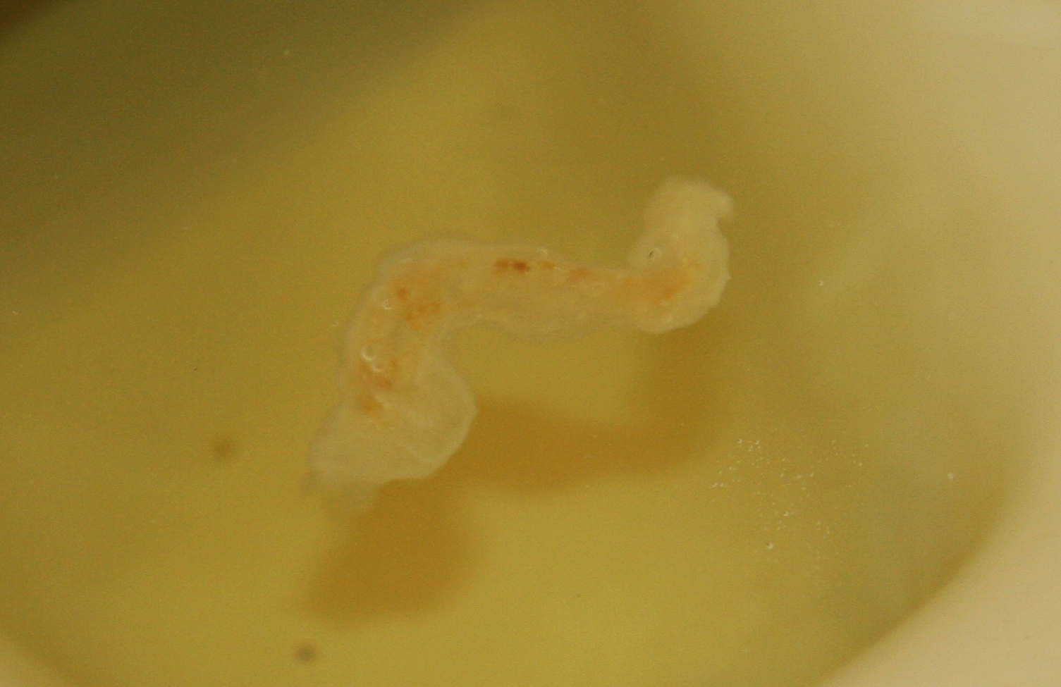 pin worms and mucus poop