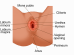 labia majora